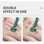 Dispozitiv Electric de Masaj cu Ventuze – 12 Niveluri - imagine 4
